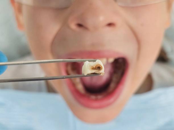 Best Cosmetic Emergency Dentistry in Byron, GA